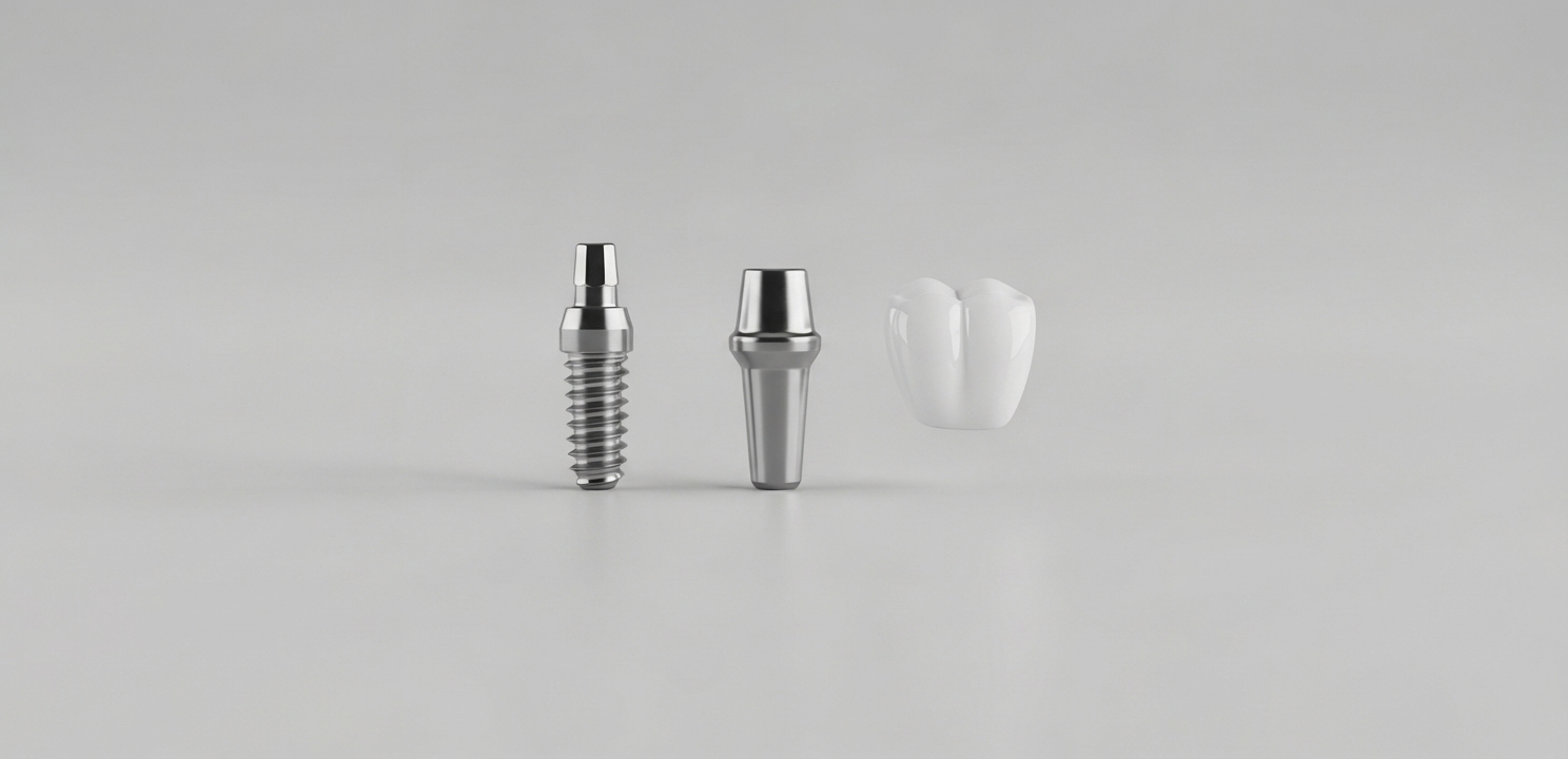 Structure d'un implant dentaire complet Implants Dentaires Italie : comprendre les trois éléments clés qui composent le traitement complet.