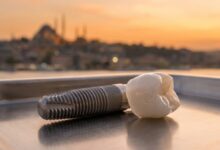 Immagine fotorealistica di un impianto dentale in titanio e una corona in zirconio in primo piano, con una vista panoramica sfocata di Istanbul al tramonto sullo sfondo, a rappresentare il turismo dentale in Turchia.