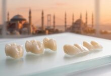 Un'immagine di corone e faccette dentali in ceramica di alta qualità in primo piano, con lo skyline di Istanbul sfocato sullo sfondo al tramonto, a simboleggiare l'eccellenza del turismo dentale in Turchia.
