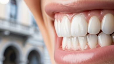 Primo piano di un sorriso radioso con denti bianchi e allineati, risultato di faccette dentali. Lo sfondo è un paesaggio urbano italiano molto sfocato, che aggiunge contesto di location senza distrarre.