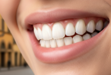 Primo piano di un sorriso luminoso e perfettamente bianco, con denti sani e splendenti. Le labbra sono delicatamente curvate in un'espressione felice. Lo sfondo è estremamente sfocato ma suggerisce un ambiente urbano italiano con luce calda.