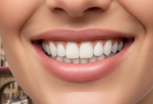 Una foto ravvicinata e dettagliata di un sorriso sano e radioso con denti bianchi, allineati e dall'aspetto naturale. Le labbra sono leggermente aperte e lo sfondo è un paesaggio urbano italiano sottilmente sfocato.
