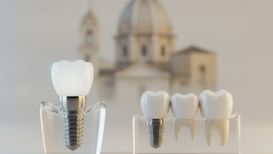 Immagine ravvicinata e dettagliata di modelli concettuali di un impianto dentale e un ponte dentale, posizionati su uno sfondo pulito e moderno. Sullo sfondo sfocato si intravede un elemento architettonico italiano. L'illuminazione è cinematografica e la profondità di campo è bassa.