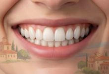 Primo piano fotorealistico di un sorriso perfetto con denti bianchi, sani e ben allineati, su uno sfondo sfocato che suggerisce un paesaggio o architettura italiana.