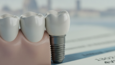 Immagine ravvicinata e dettagliata di un impianto dentale moderno con corona in ceramica, inserito in una gengiva sana. Lo sfondo è sfocato e suggerisce documenti finanziari e un paesaggio urbano italiano lontano, senza testo visibile.